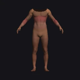 Bandit 1 · Körperkomponente