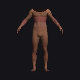 Bandit 2 · Körperkomponente